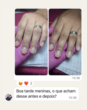 Depoimento 1